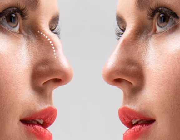 Plastic Surgeon