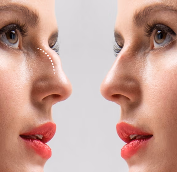 Plastic Surgeon